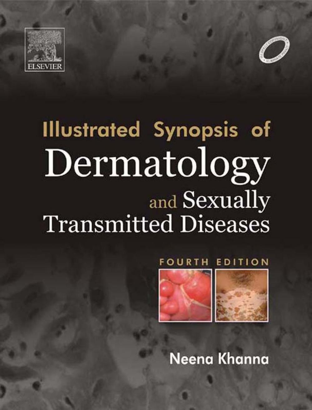 Big bigCover of Illustrated Synopsis of Dermatology & Sexually Transmitted Diseases - E-book