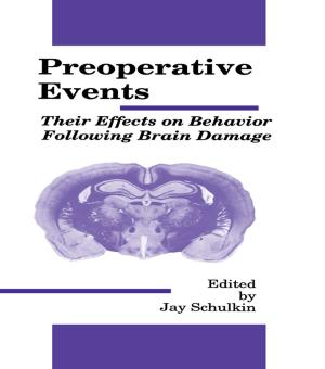 Cover of the book Preoperative Events by Lawrence A. Brown