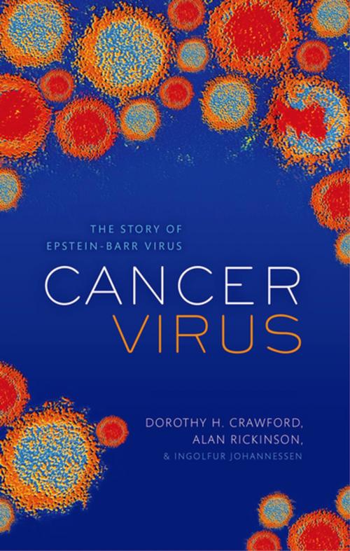 Cover of the book Cancer Virus by Dorothy H. Crawford, Alan B. Rickinson, Ingólfur Johannessen, OUP Oxford