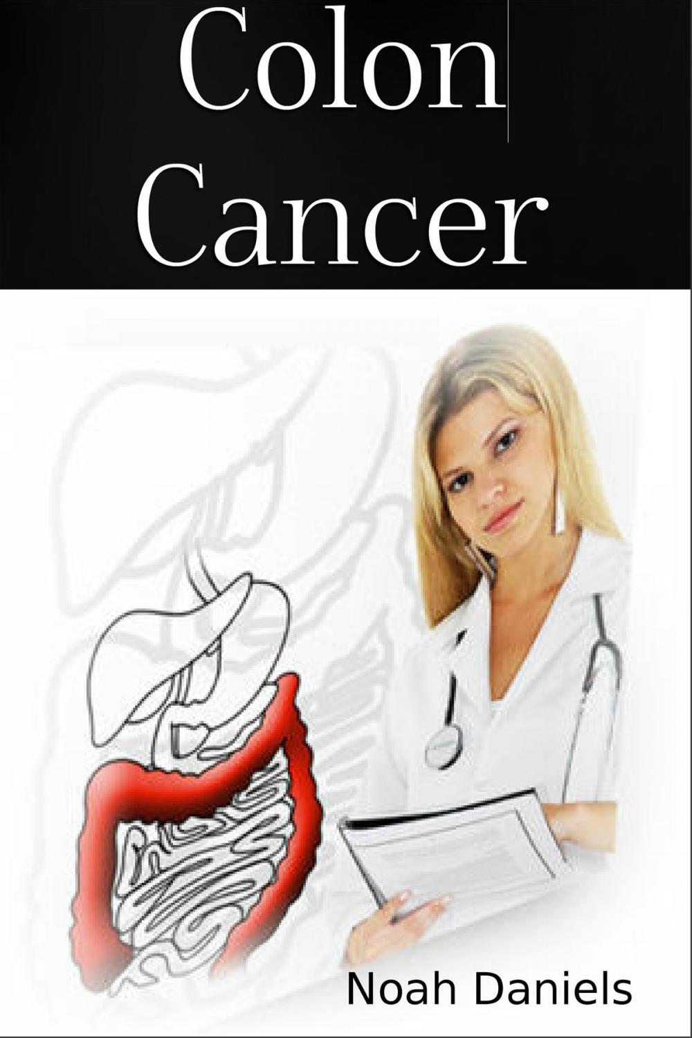 Big bigCover of Colon Cancer