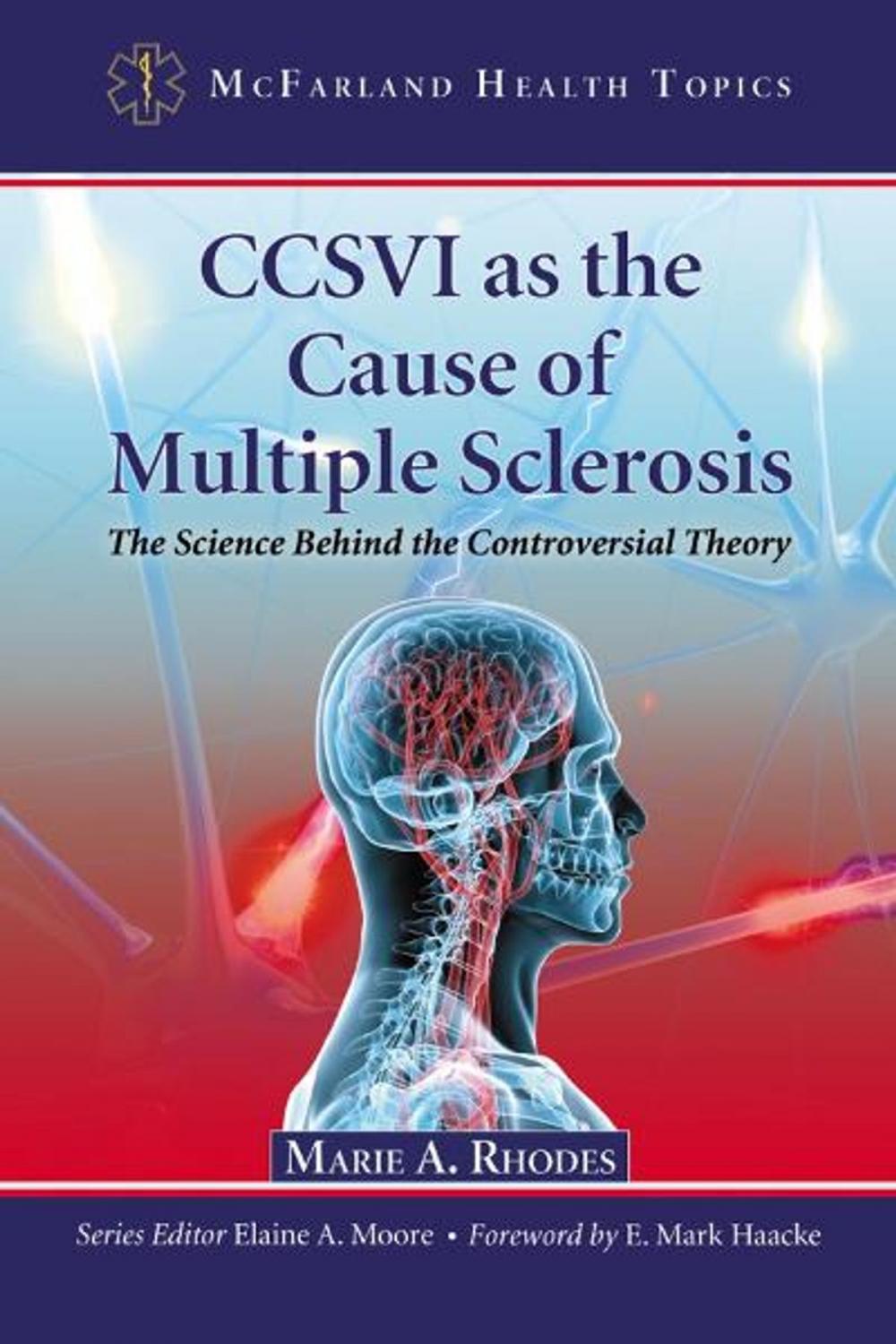 Big bigCover of CCSVI as the Cause of Multiple Sclerosis