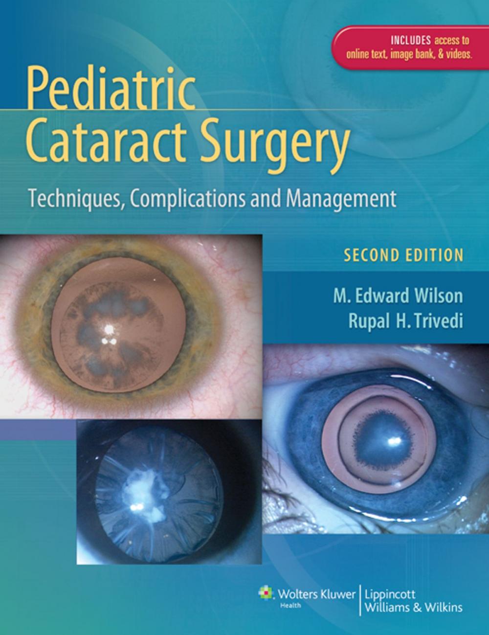 Big bigCover of Pediatric Cataract Surgery