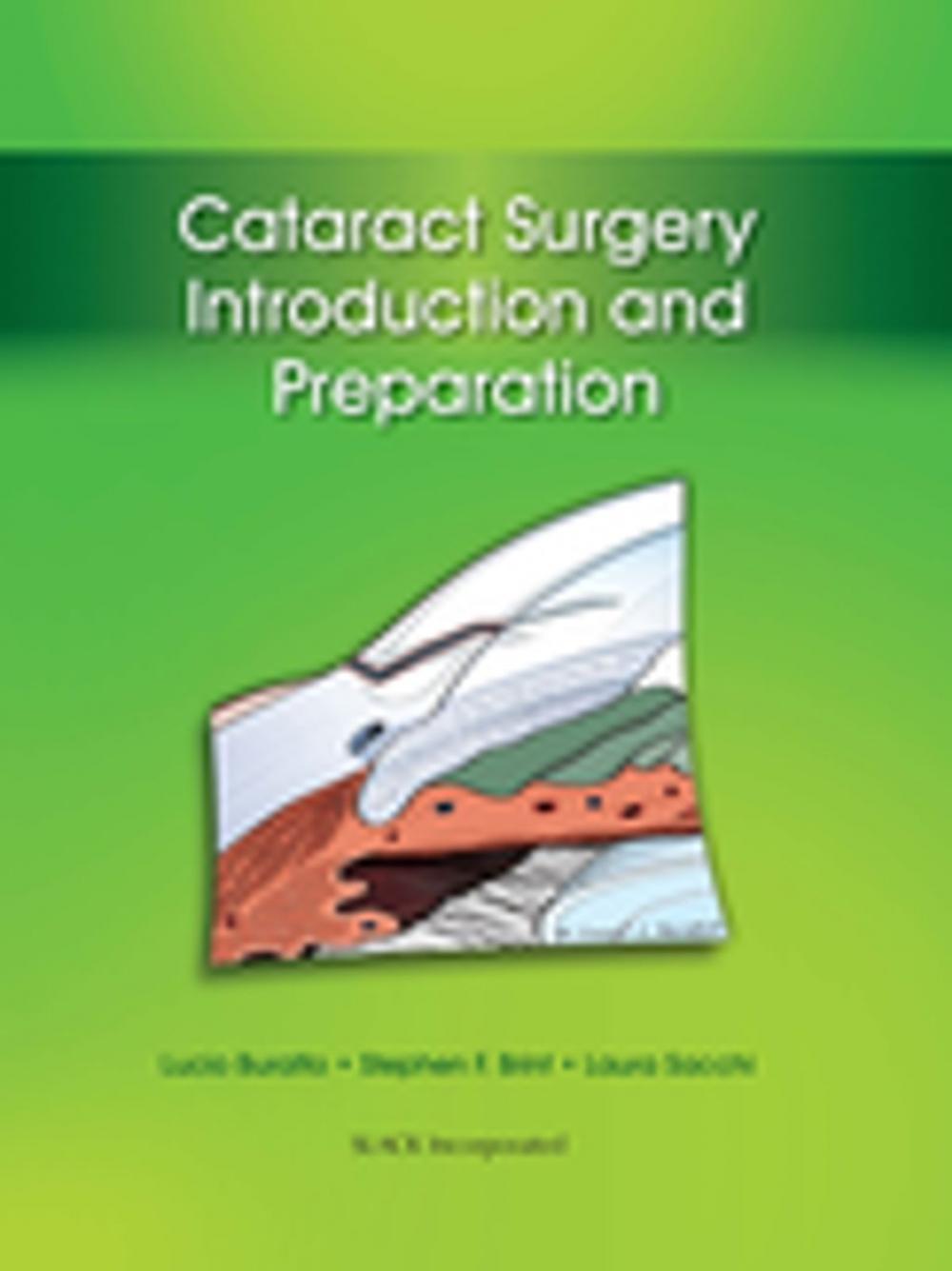 Big bigCover of Cataract Surgery