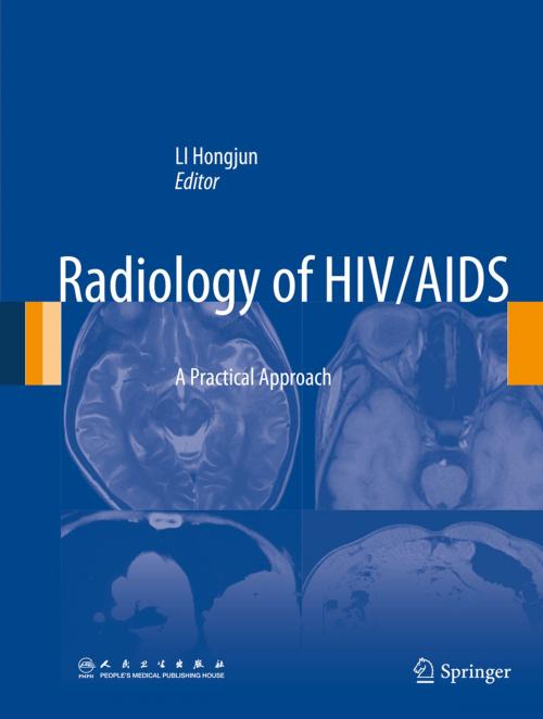 Cover of the book Radiology of HIV/AIDS by , Springer Netherlands