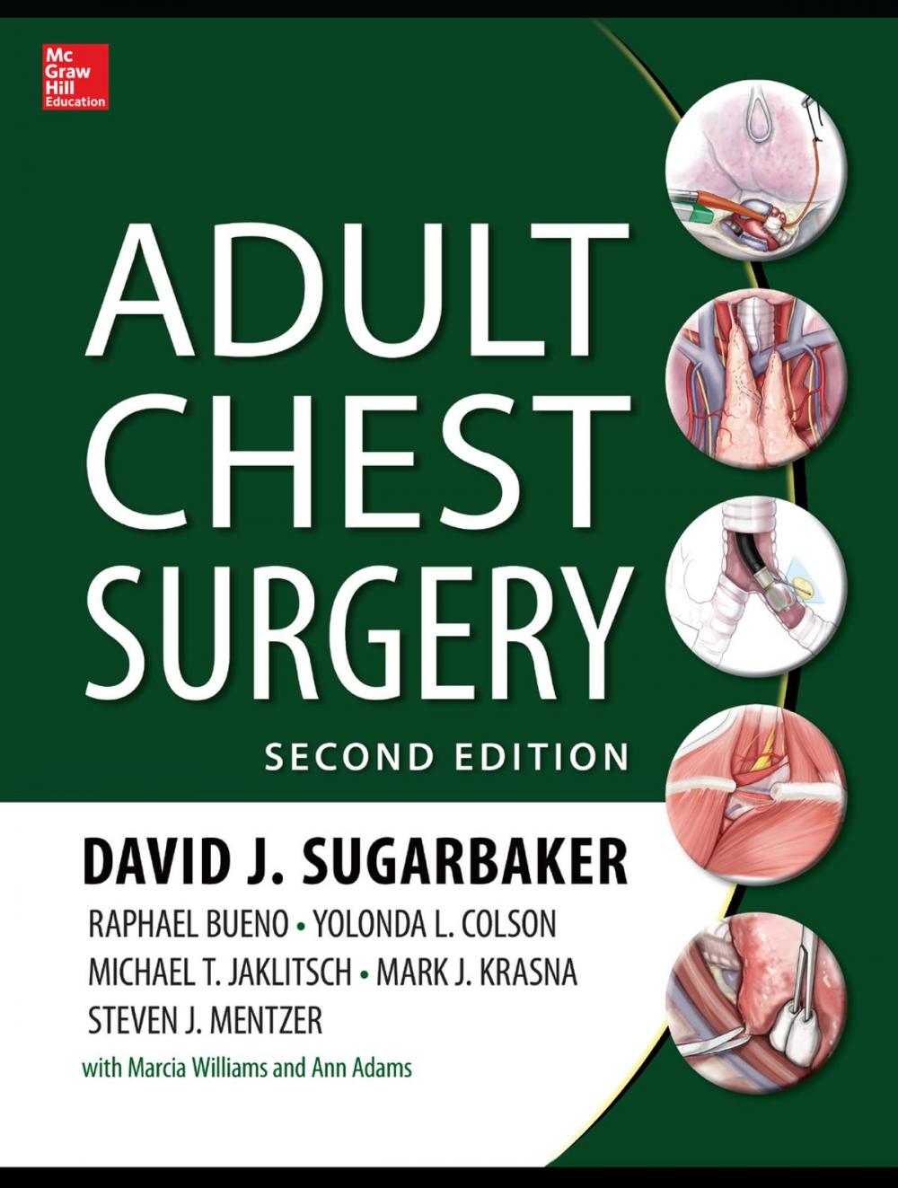 Big bigCover of Adult Chest Surgery, 2nd edition