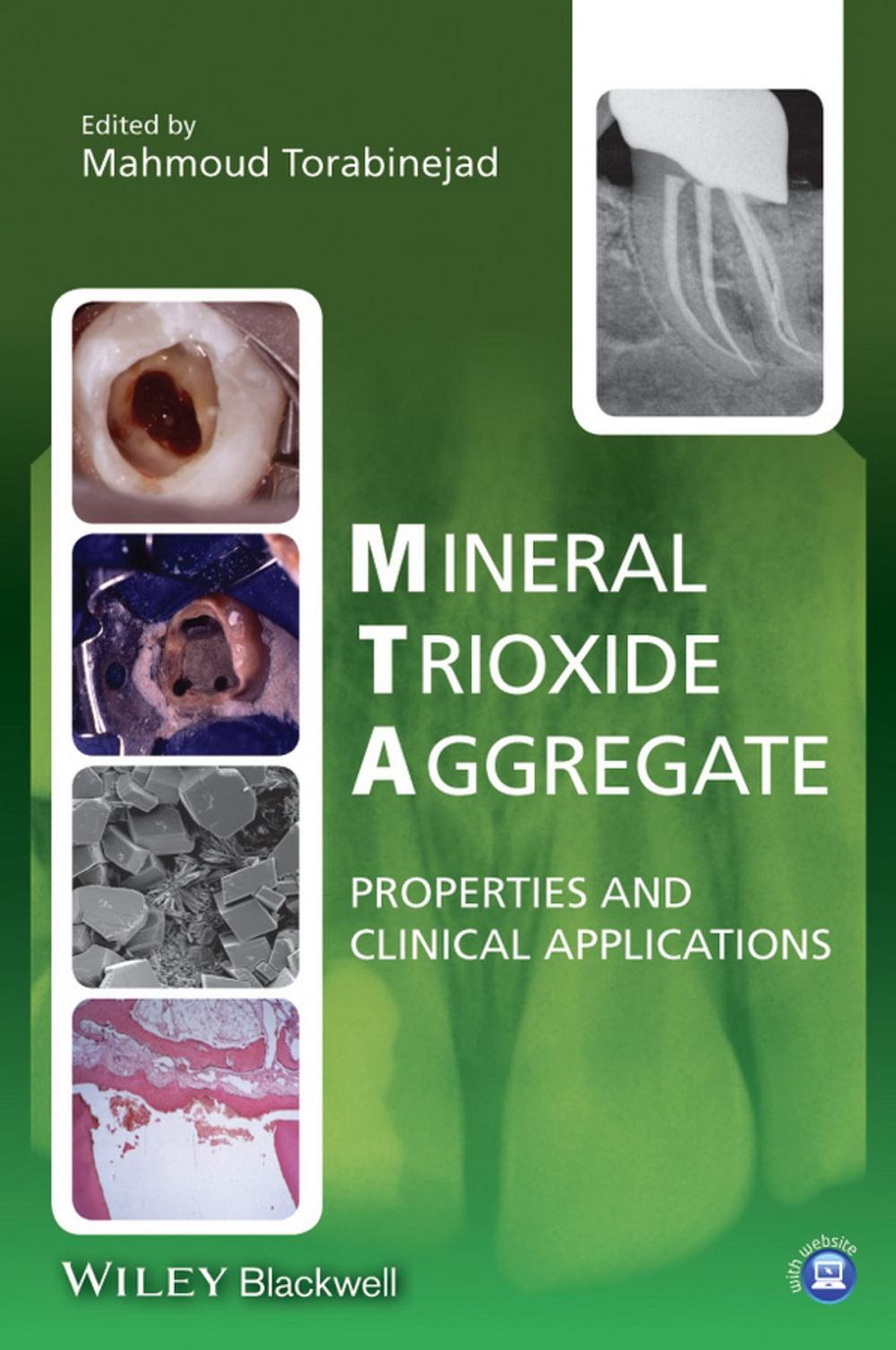 Big bigCover of Mineral Trioxide Aggregate