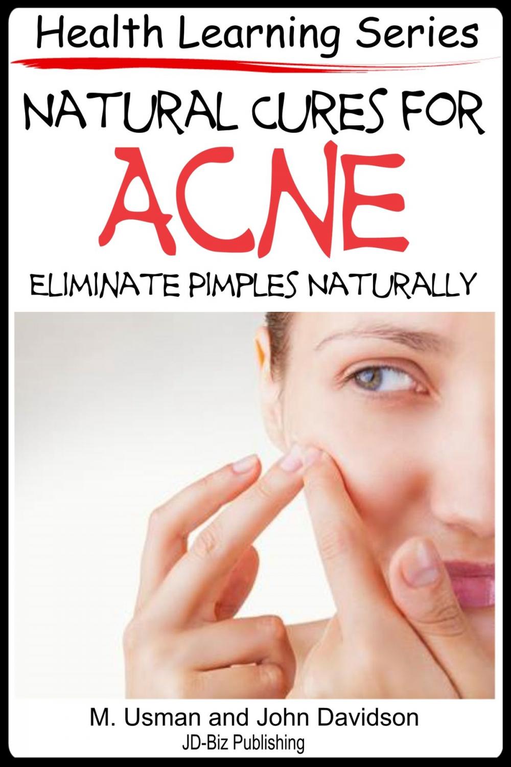 Big bigCover of Natural Cures for Acne