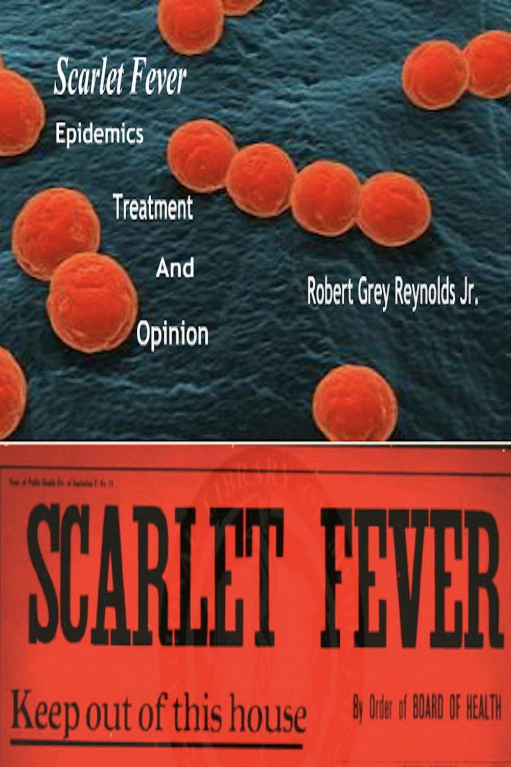 Big bigCover of Scarlet Fever Epidemics Treatment And Opinion