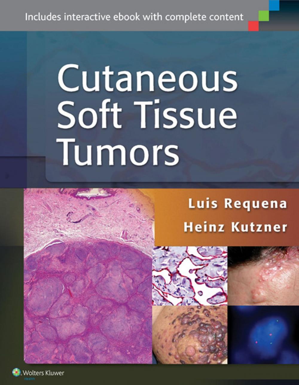 Big bigCover of Cutaneous Soft Tissue Tumors