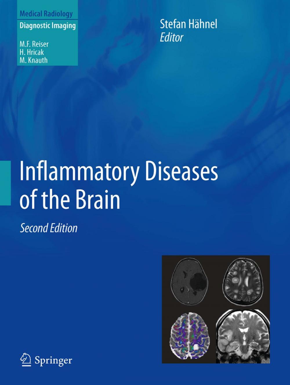 Big bigCover of Inflammatory Diseases of the Brain