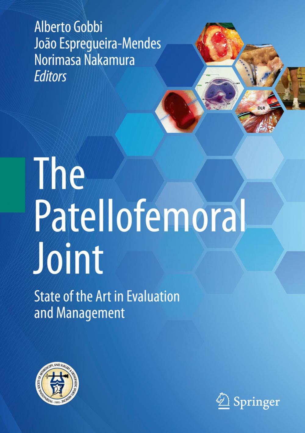 Big bigCover of The Patellofemoral Joint