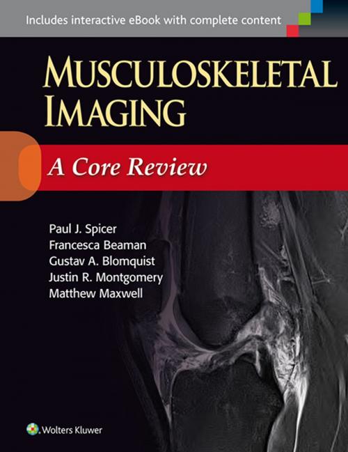 Cover of the book Musculoskeletal Imaging: A Core Review by Paul Spicer, Wolters Kluwer Health