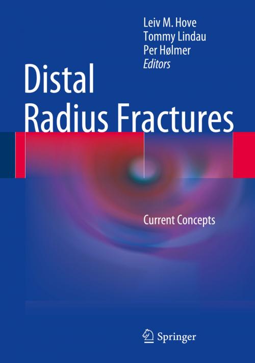 Cover of the book Distal Radius Fractures by , Springer Berlin Heidelberg