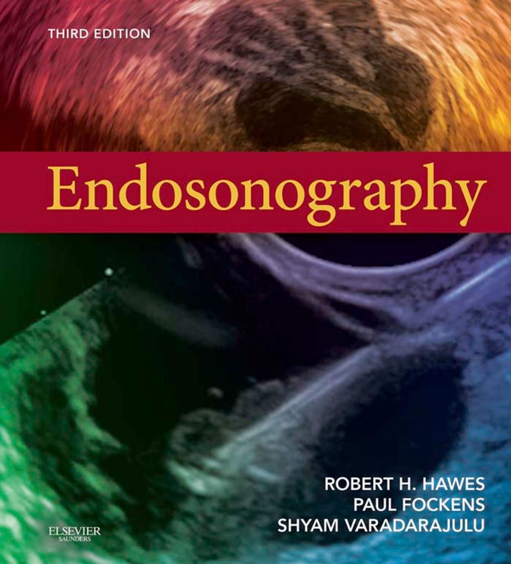 Big bigCover of Endosonography E-Book