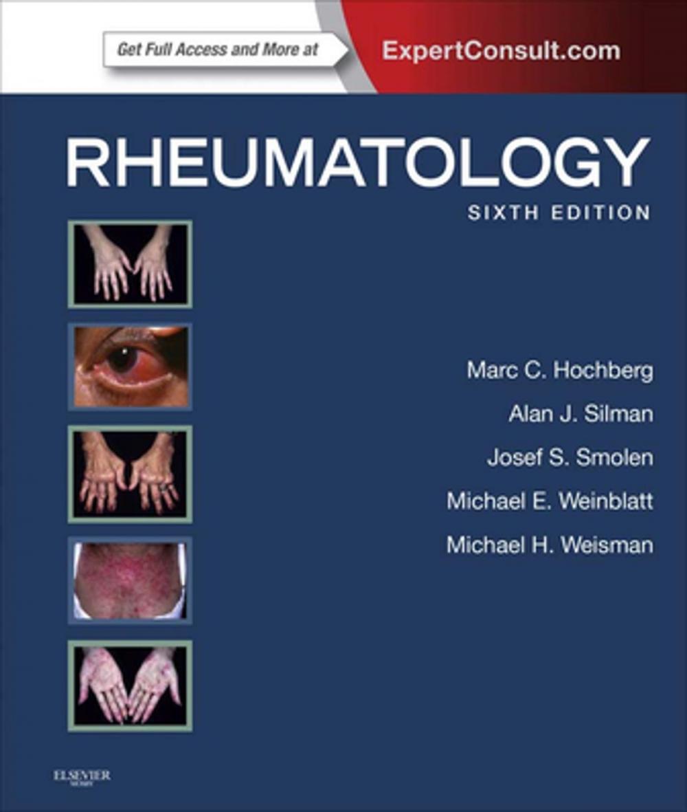 Big bigCover of Rheumatology E-Book