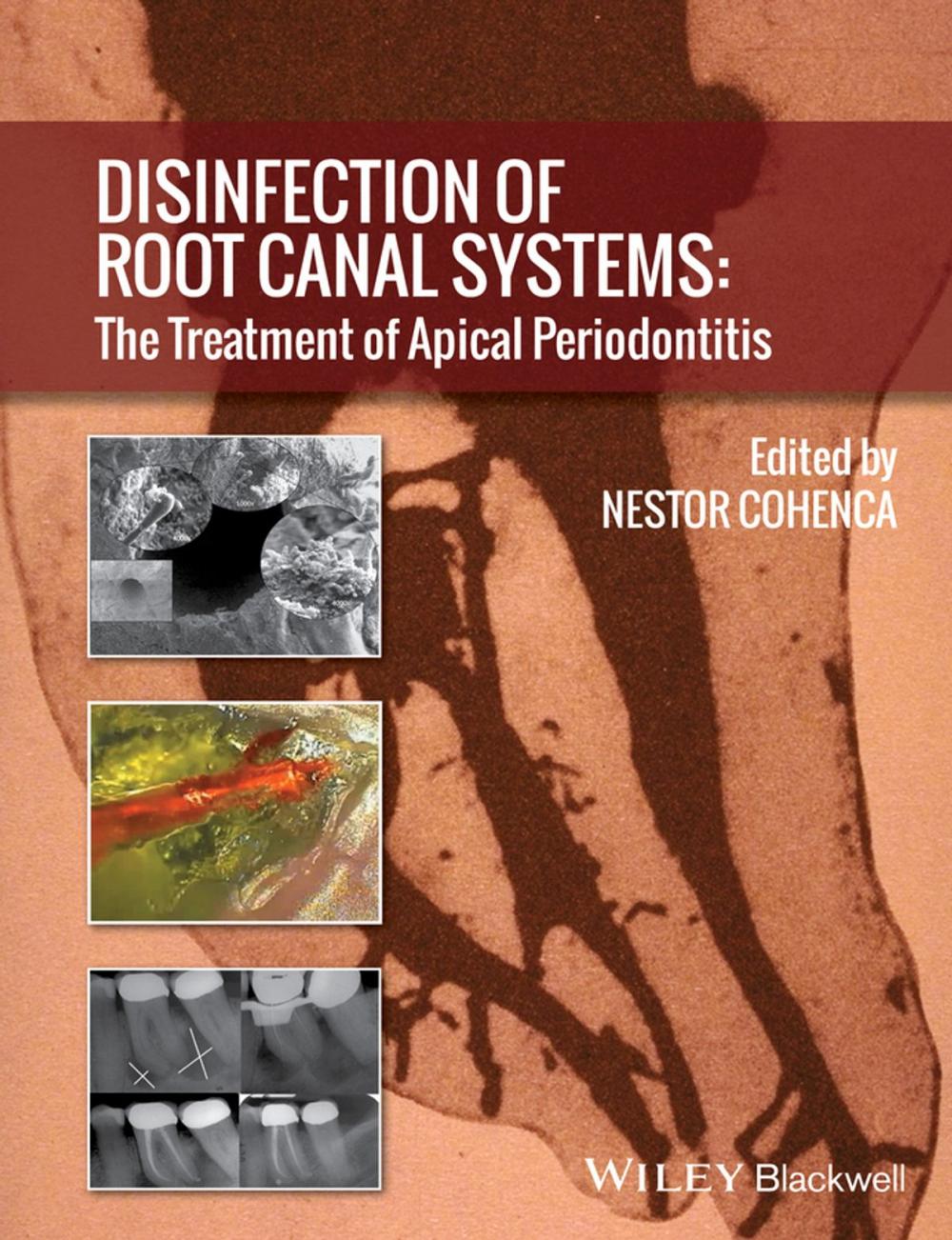 Big bigCover of Disinfection of Root Canal Systems