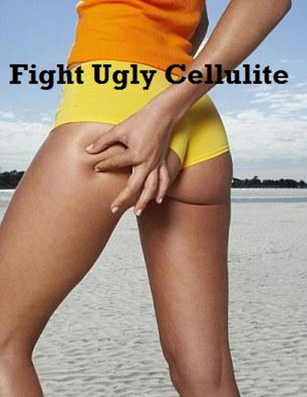 Big bigCover of Fight Ugly Cellulite