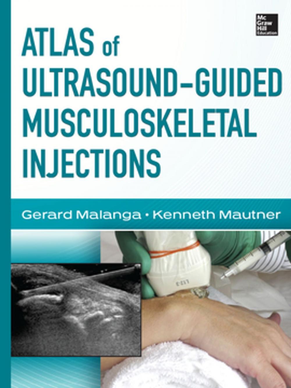 Big bigCover of Atlas of Ultrasound-Guided Musculoskeletal Injections