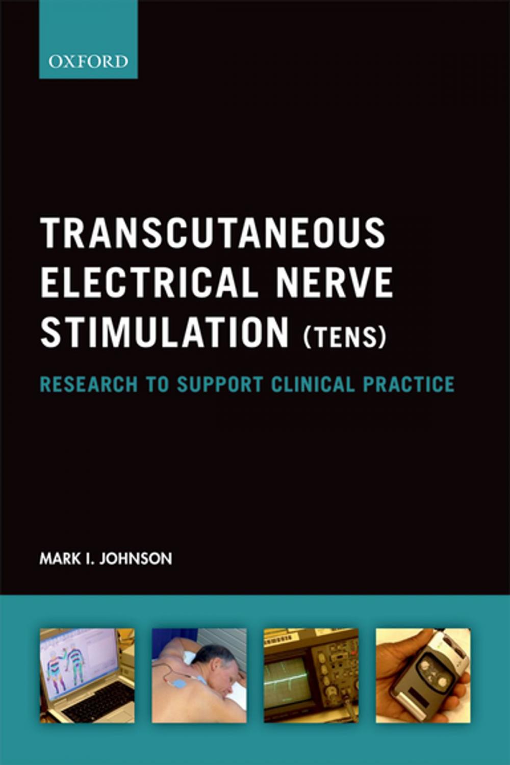 Big bigCover of Transcutaneous Electrical Nerve Stimulation (TENS)