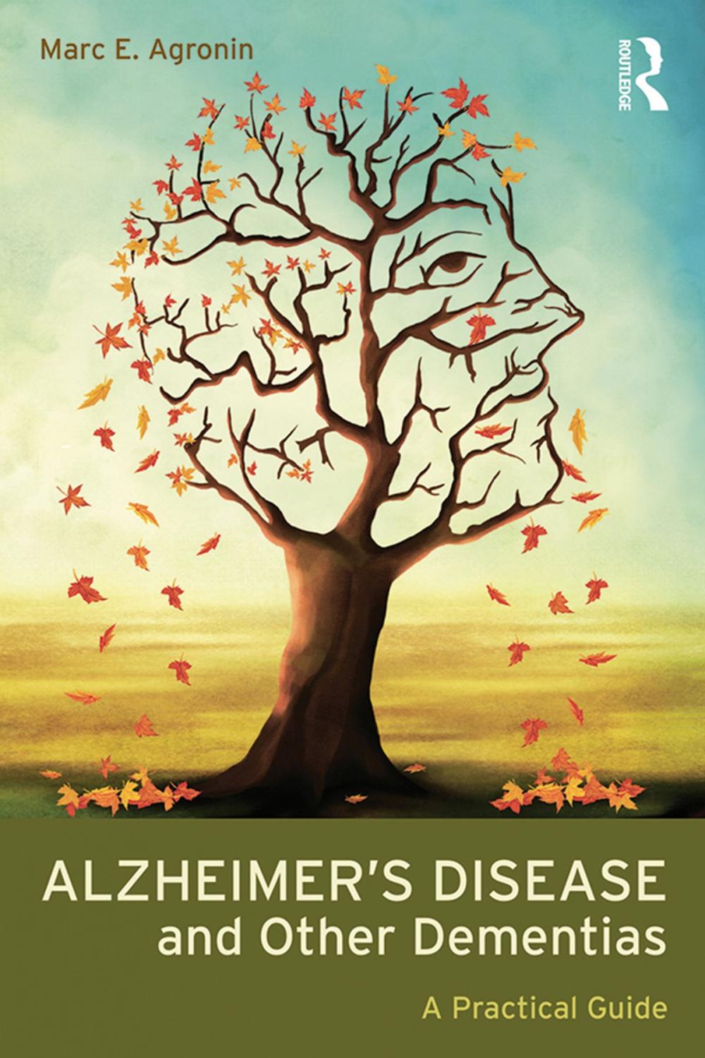 Big bigCover of Alzheimer's Disease and Other Dementias