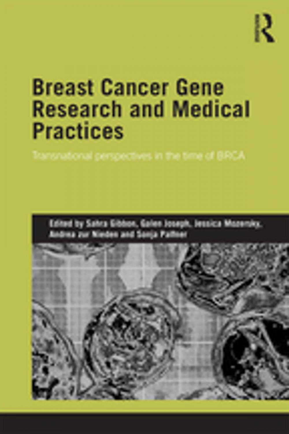 Big bigCover of Breast Cancer Gene Research and Medical Practices