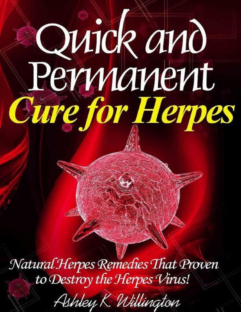 Big bigCover of Quick and Permanent Cure for Herpes: Natural Herpes Remedies That Proven to Destroy the Herpes Virus!