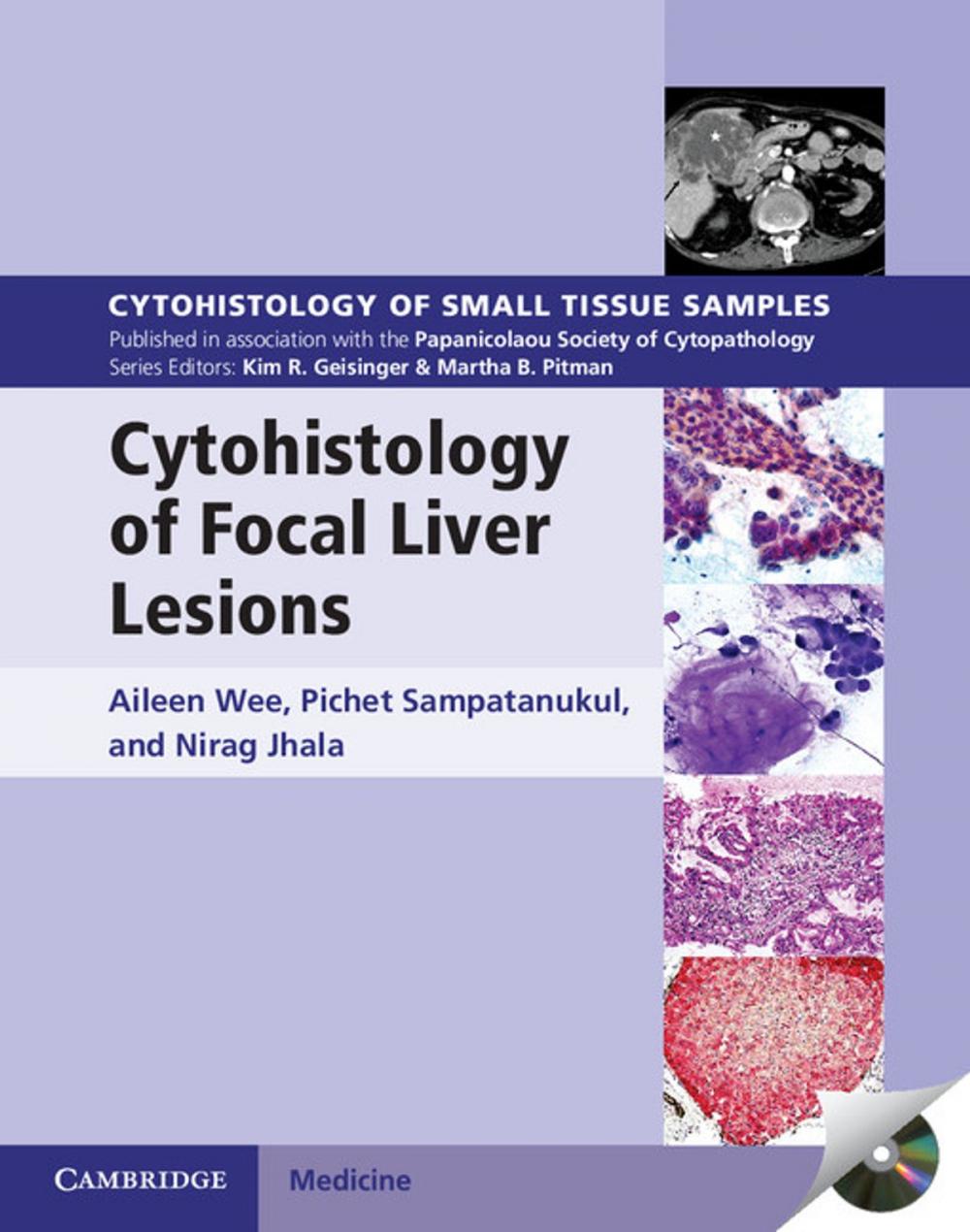 Big bigCover of Cytohistology of Focal Liver Lesions