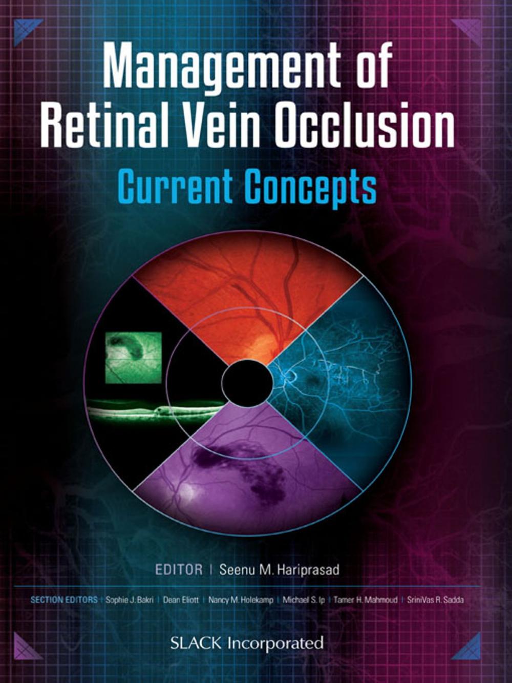 Big bigCover of Management of Retinal Vein Occlusion