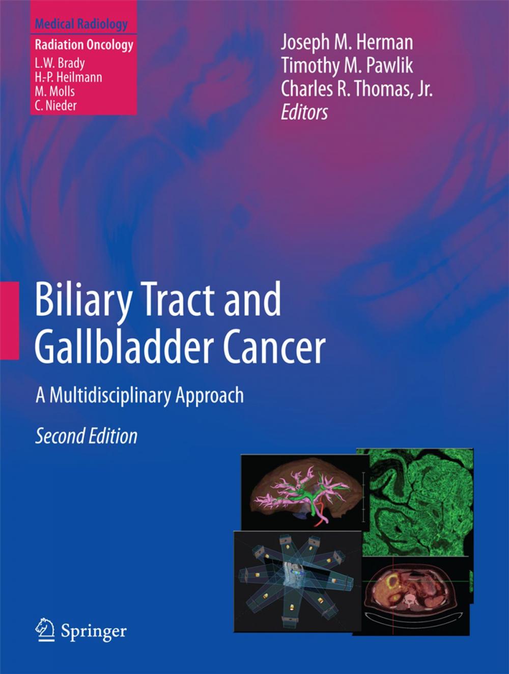 Big bigCover of Biliary Tract and Gallbladder Cancer