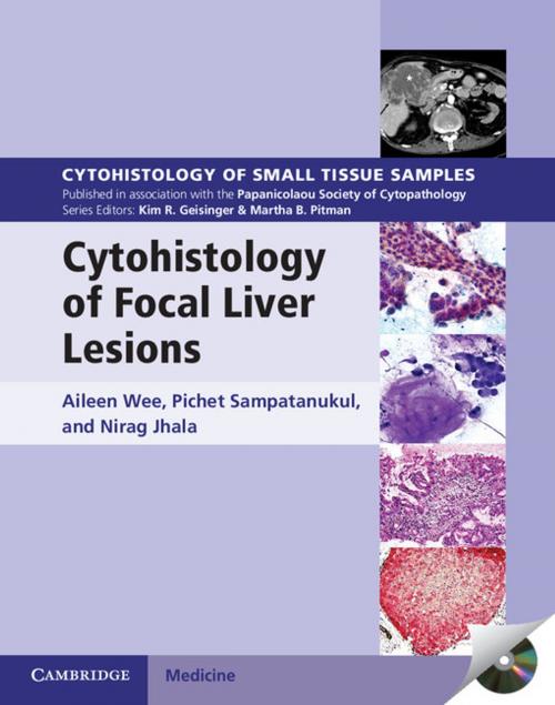 Cover of the book Cytohistology of Focal Liver Lesions by Aileen Wee, Pichet Sampatanukul, Nirag Jhala, Cambridge University Press