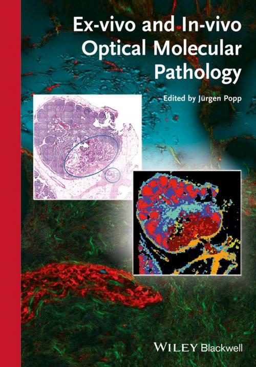 Cover of the book Ex-vivo and In-vivo Optical Molecular Pathology by , Wiley