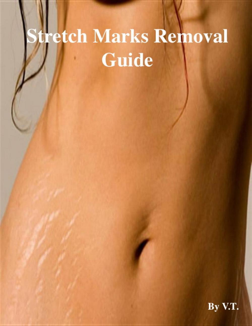 Big bigCover of Stretch Marks Removal Guide