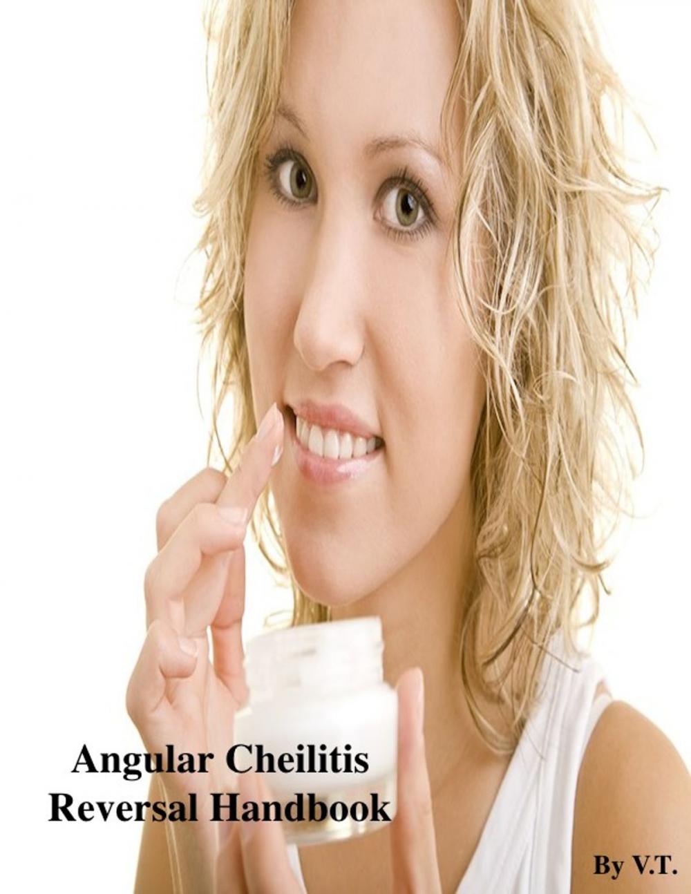 Big bigCover of Angular Cheilitis Reversal Handbook