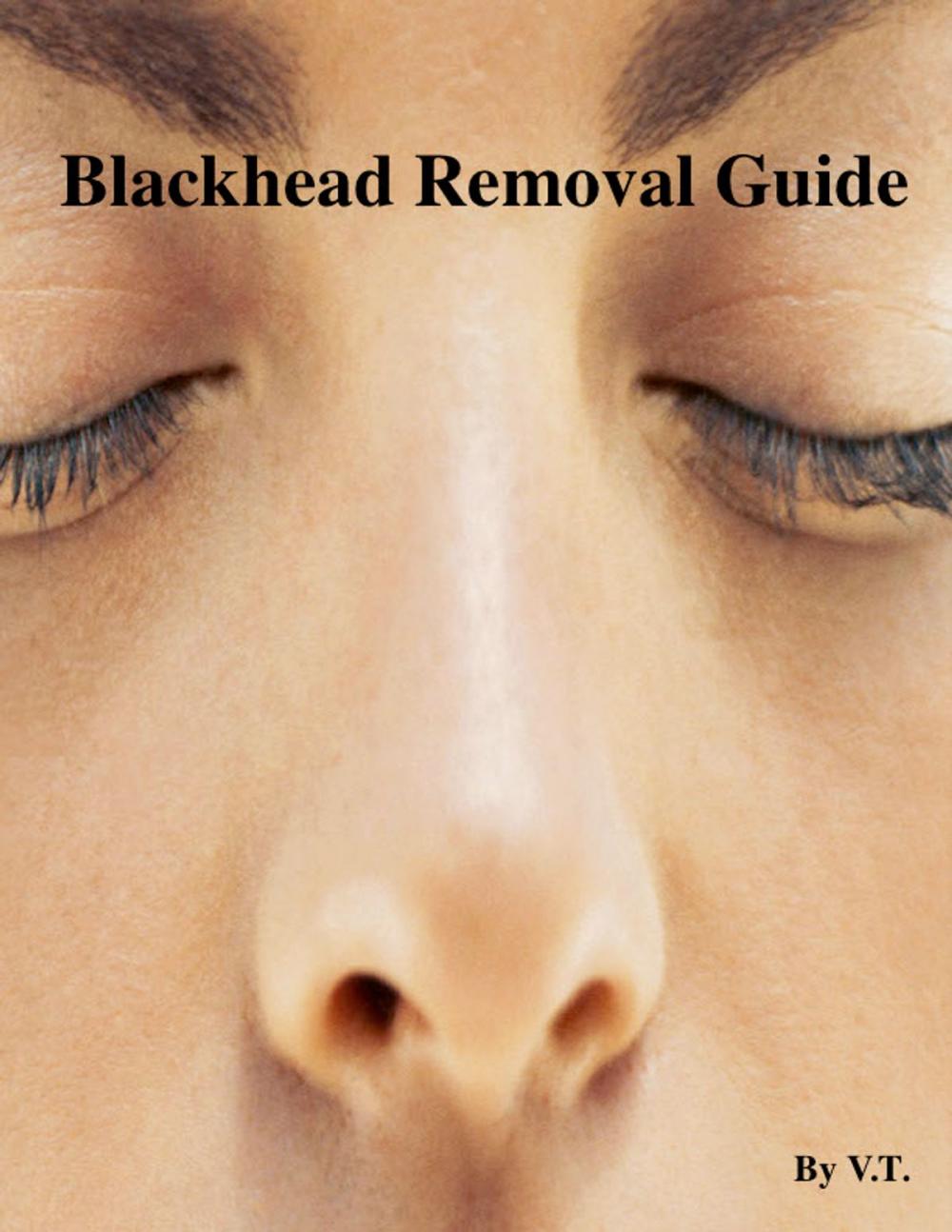 Big bigCover of Blackhead Removal Guide