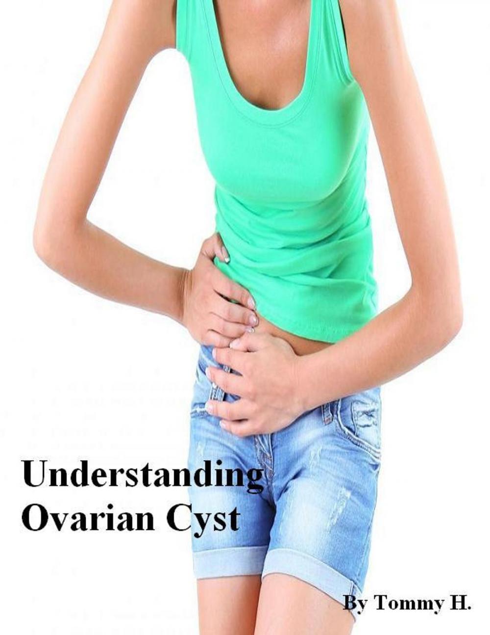 Big bigCover of Understanding Ovarian Cyst