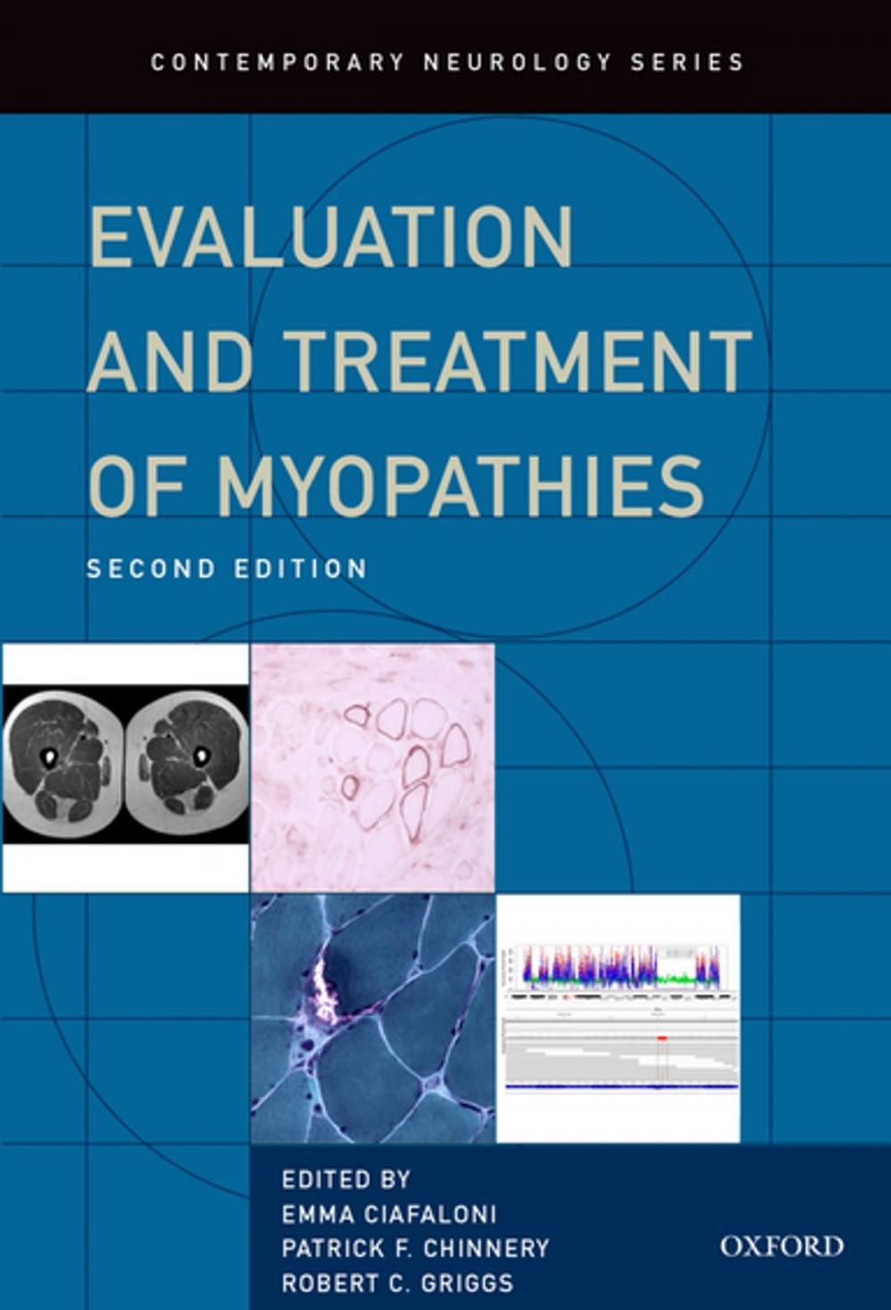 Big bigCover of Evaluation and Treatment of Myopathies