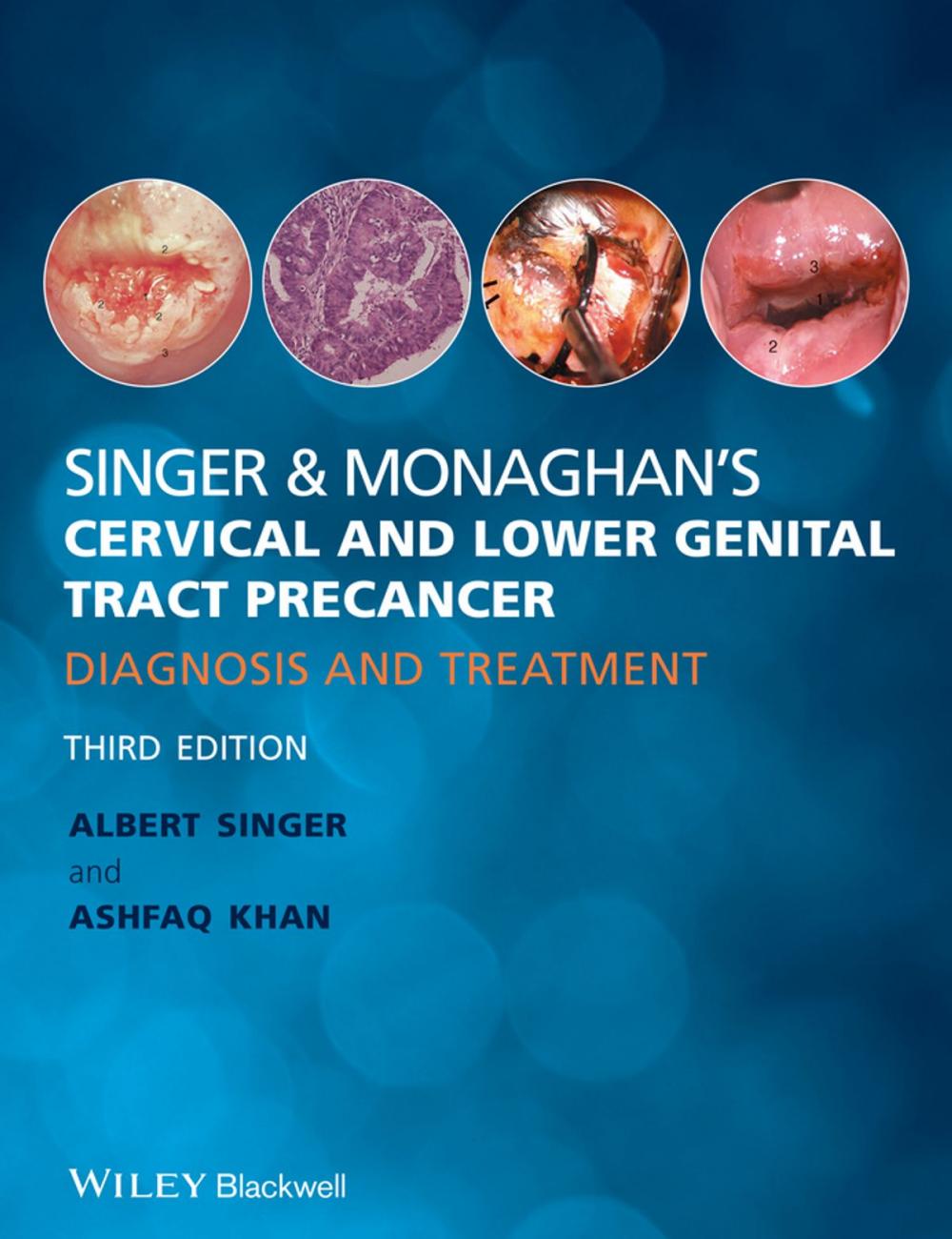 Big bigCover of Singer and Monaghan's Cervical and Lower Genital Tract Precancer