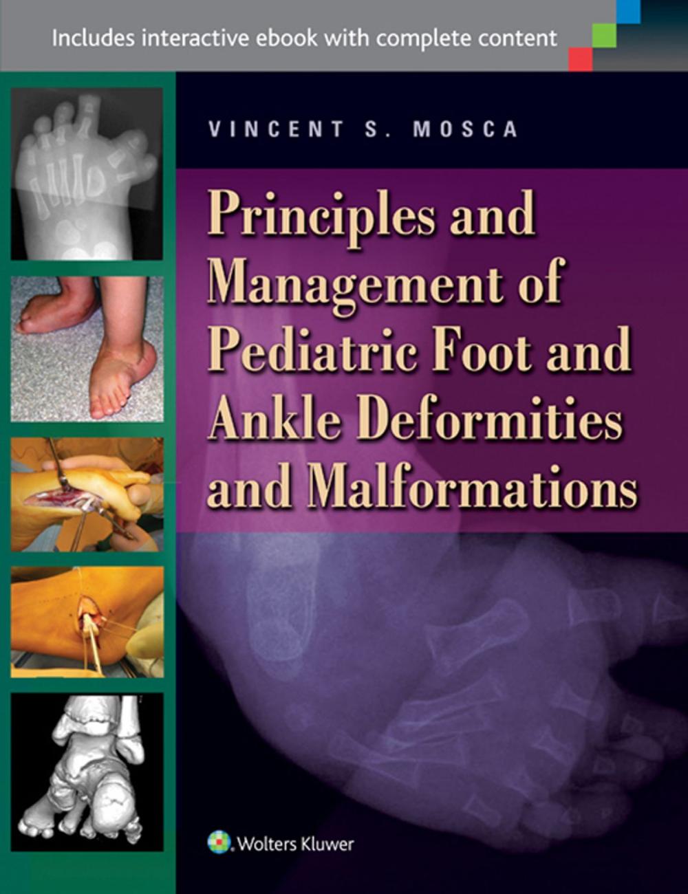 Big bigCover of Principles and Management of Pediatric Foot and Ankle Deformities and Malformations