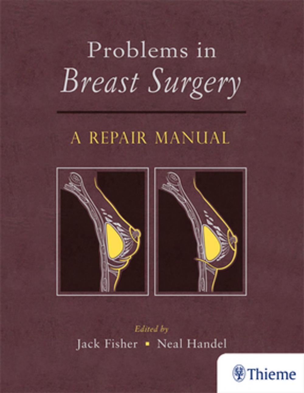 Big bigCover of Problems in Breast Surgery