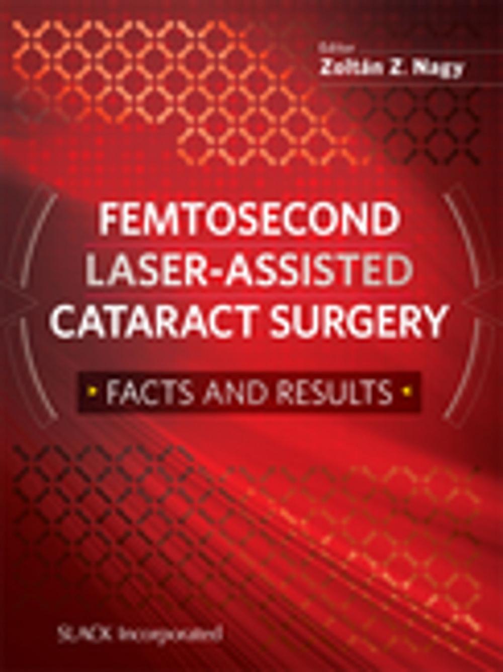 Big bigCover of Femtosecond Laser-Assisted Cataract Surgery