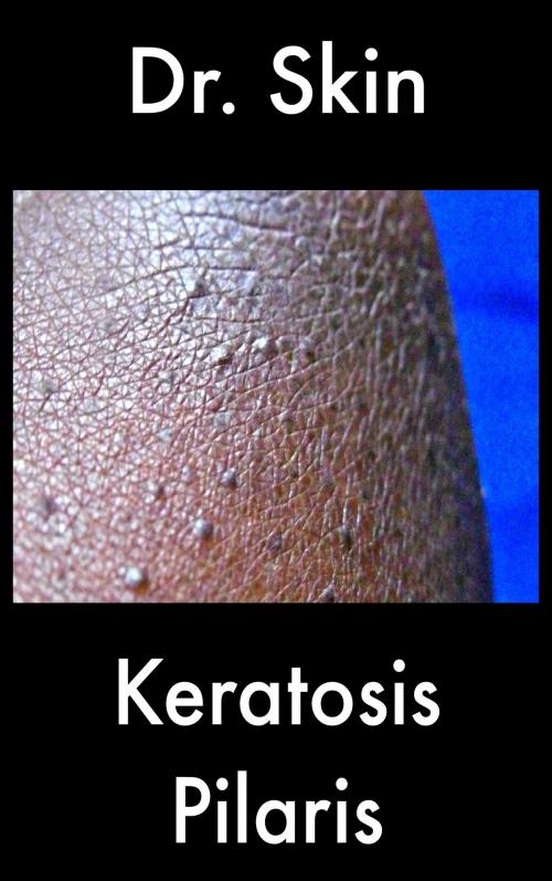 Cover of the book Keratosis Pilaris by Dr Skin, Dr Skin