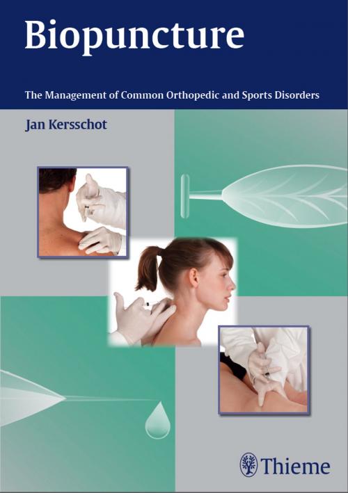 Cover of the book Biopuncture by Jan Kersschot, Thieme