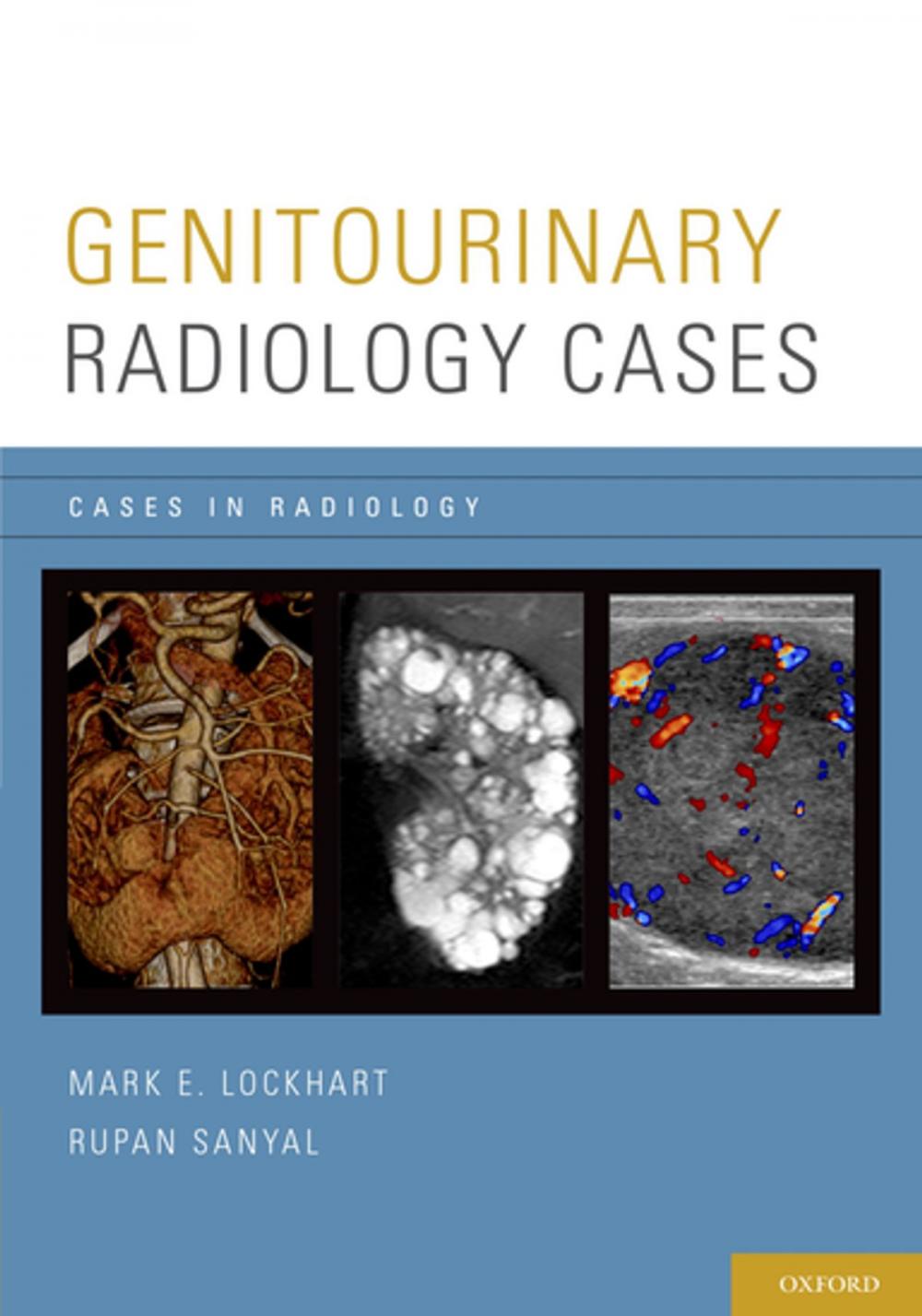 Big bigCover of Genitourinary Radiology Cases