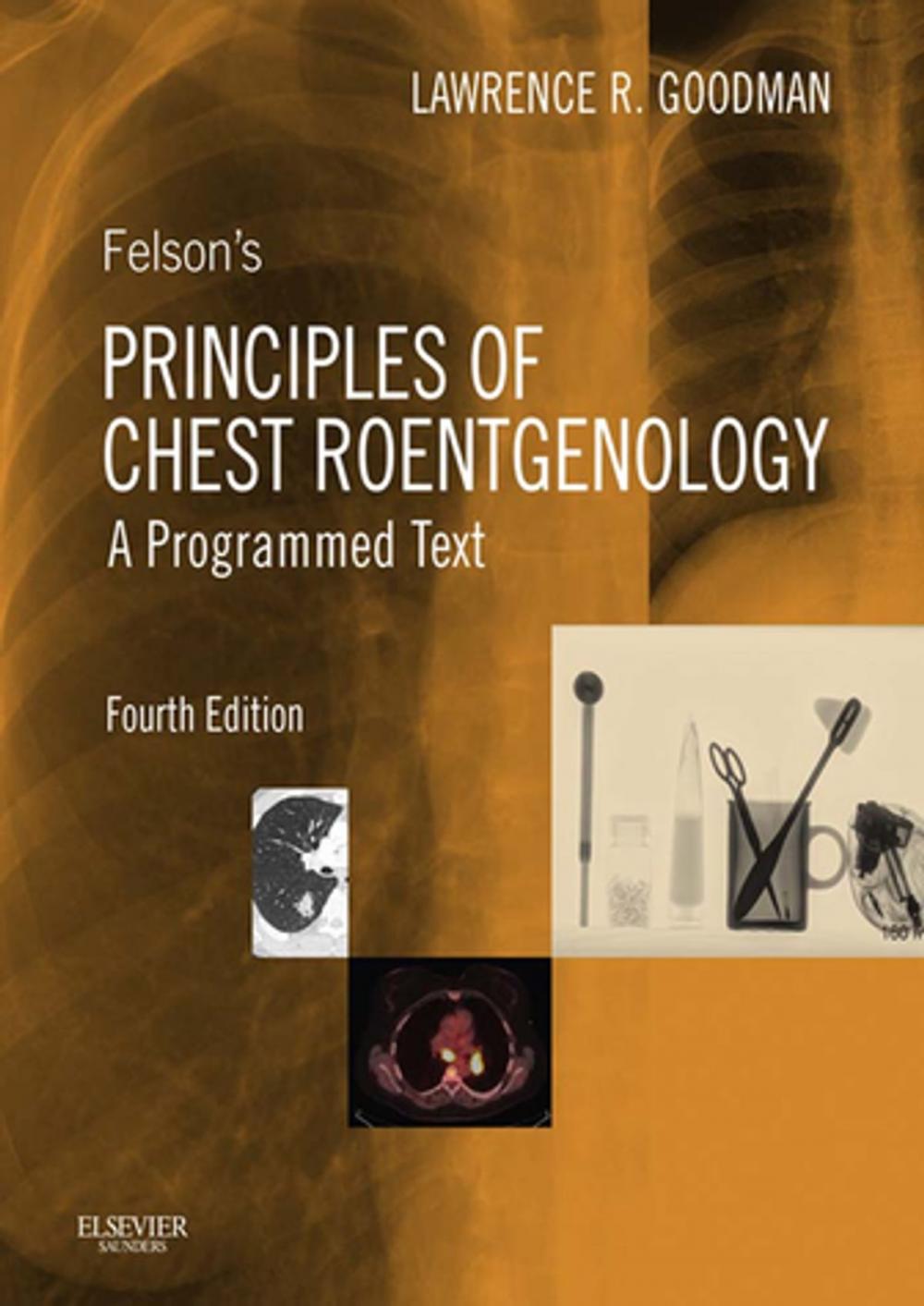 Big bigCover of Felson's Principles of Chest Roentgenology E-Book