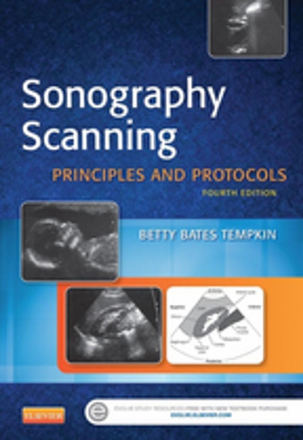 Big bigCover of Sonography Scanning - E-Book