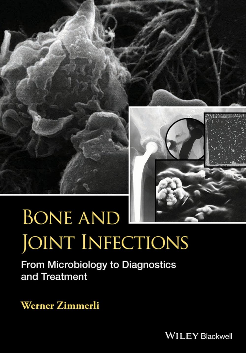 Big bigCover of Bone and Joint Infections