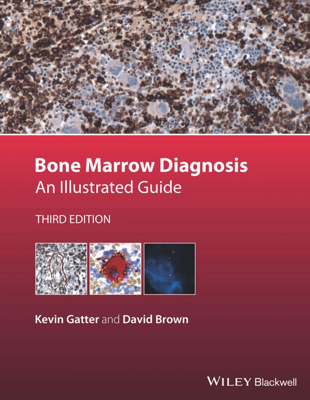 Big bigCover of Bone Marrow Diagnosis