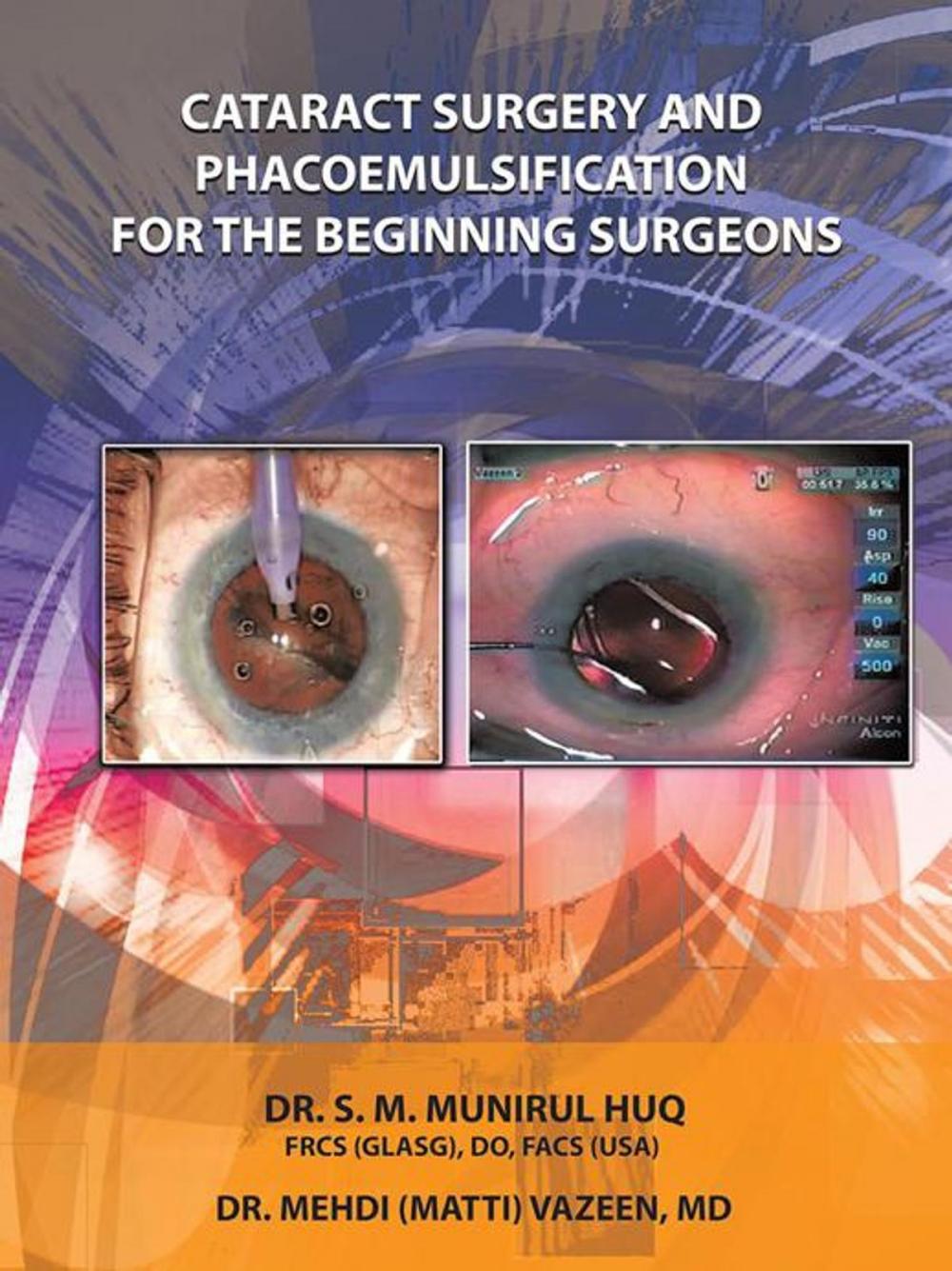 Big bigCover of Cataract Surgery and Phacoemulsification for the Beginning Surgeons