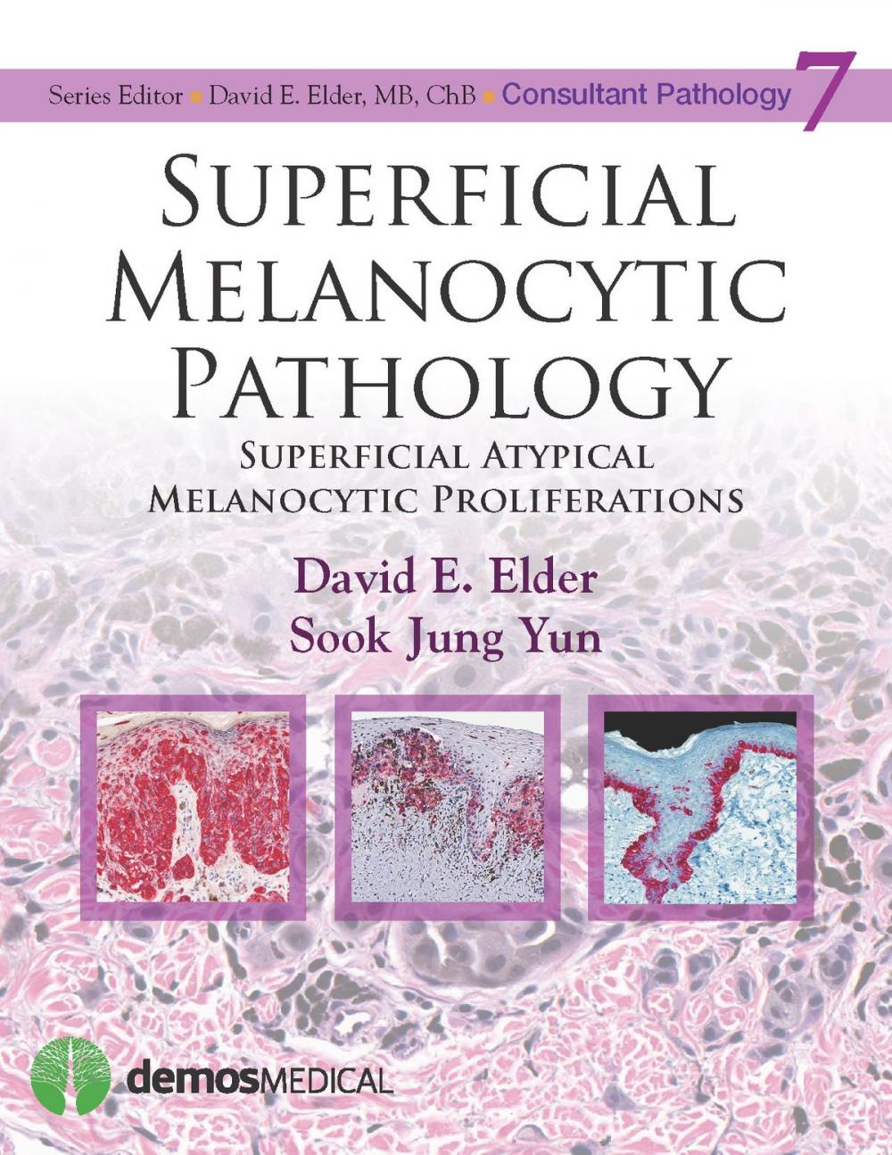 Big bigCover of Superficial Melanocytic Pathology