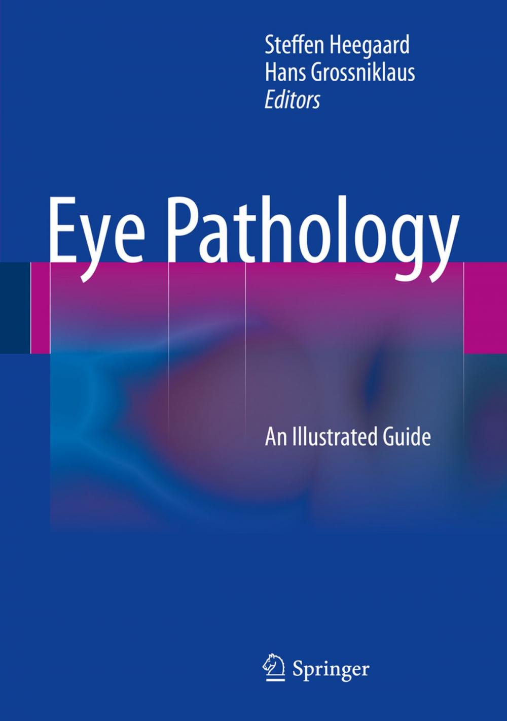 Big bigCover of Eye Pathology